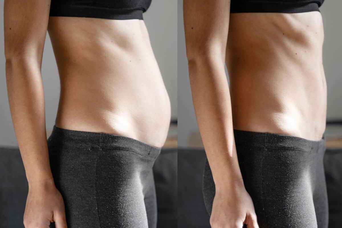 Post-Pregnancy: What Happens to Your Abdominal Muscles After Birth Upton Park
