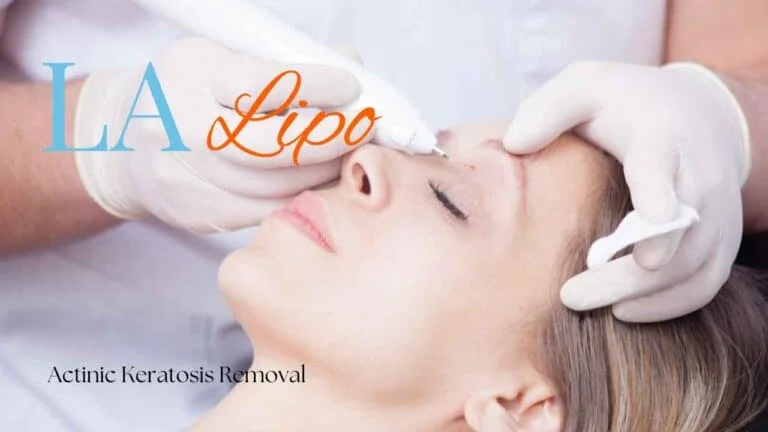 Woman receiving Actinic Keratosis Removal Treatment Upton Park