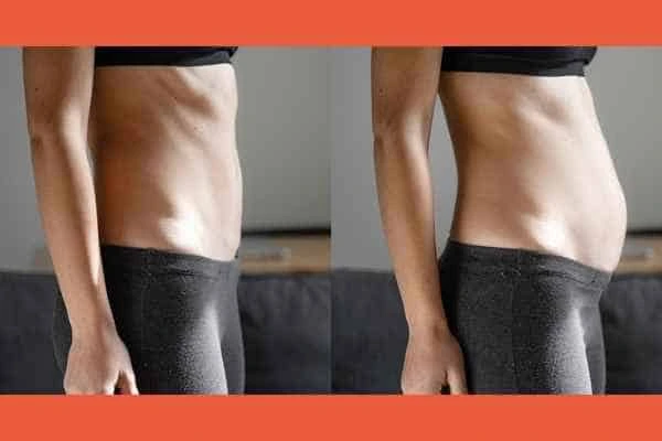 LA-EMS Body Sculpting results Upton Park