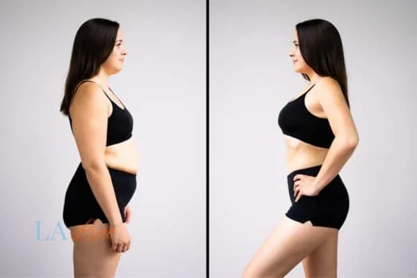 link between body image and mental health Upton Park